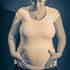 Plastic Surgery Cost in Mexico - Cosmetic Surgery Prices in 2025